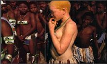 Albinos