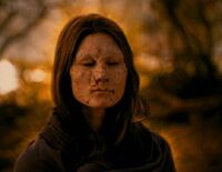 Deformed Kreeyan.jpg (29 KB) This human woman with leprosy is undergoing a special healing process.