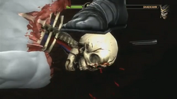 mortal kombat x ray attack