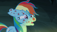 Rainbow Dash completely covered in Fly-der bites S7E16