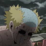 Teru's hair at the end of the ???% Arc (anime)