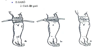 GDQP-AN 11 bài 7 hình 6