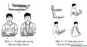 GDQP-AN 11 bài 7 hình 7