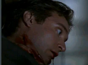 1dead