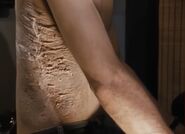 Duane’s surgery scar from when him and Belial got seperated.