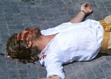 Autopsy (23)