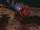 Severed limb