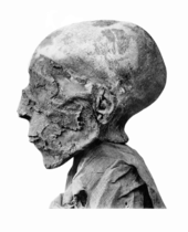 Seti II mummy head.png
