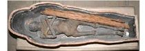 Orthopaedics-Trauma-Surgery-Related-Research-mummy-unwrapped-12-2-29-g002 (2)