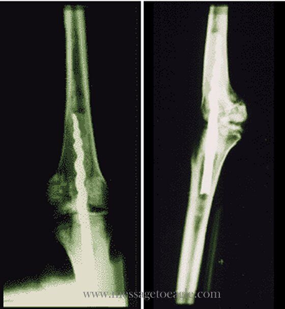 Usermontu knee.jpg