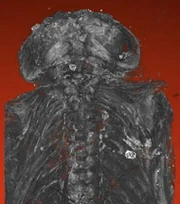 Micro-CT scan showing deformation of skull and spine
