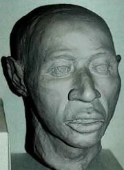 Facial Reconstruction