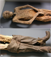 The mummy of the Baron Von Holz