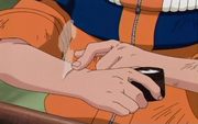 Naruto usando a pomada de Hinata
