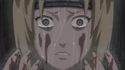 Tsunade’s traumatic loss develops hemophobia.