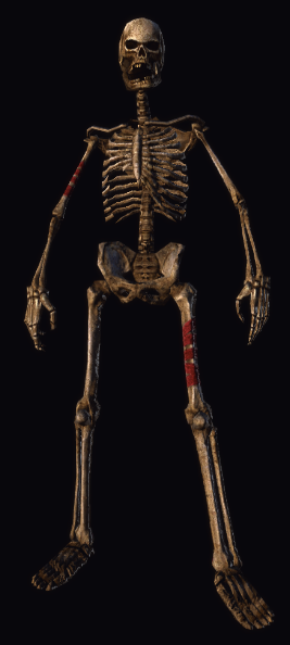Decrepit Skeleton 2.png