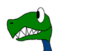 Coeloplyisis1