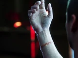 Prosthetic Hand