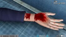 Akane's bloody wrist. Dio stole her bracelet.