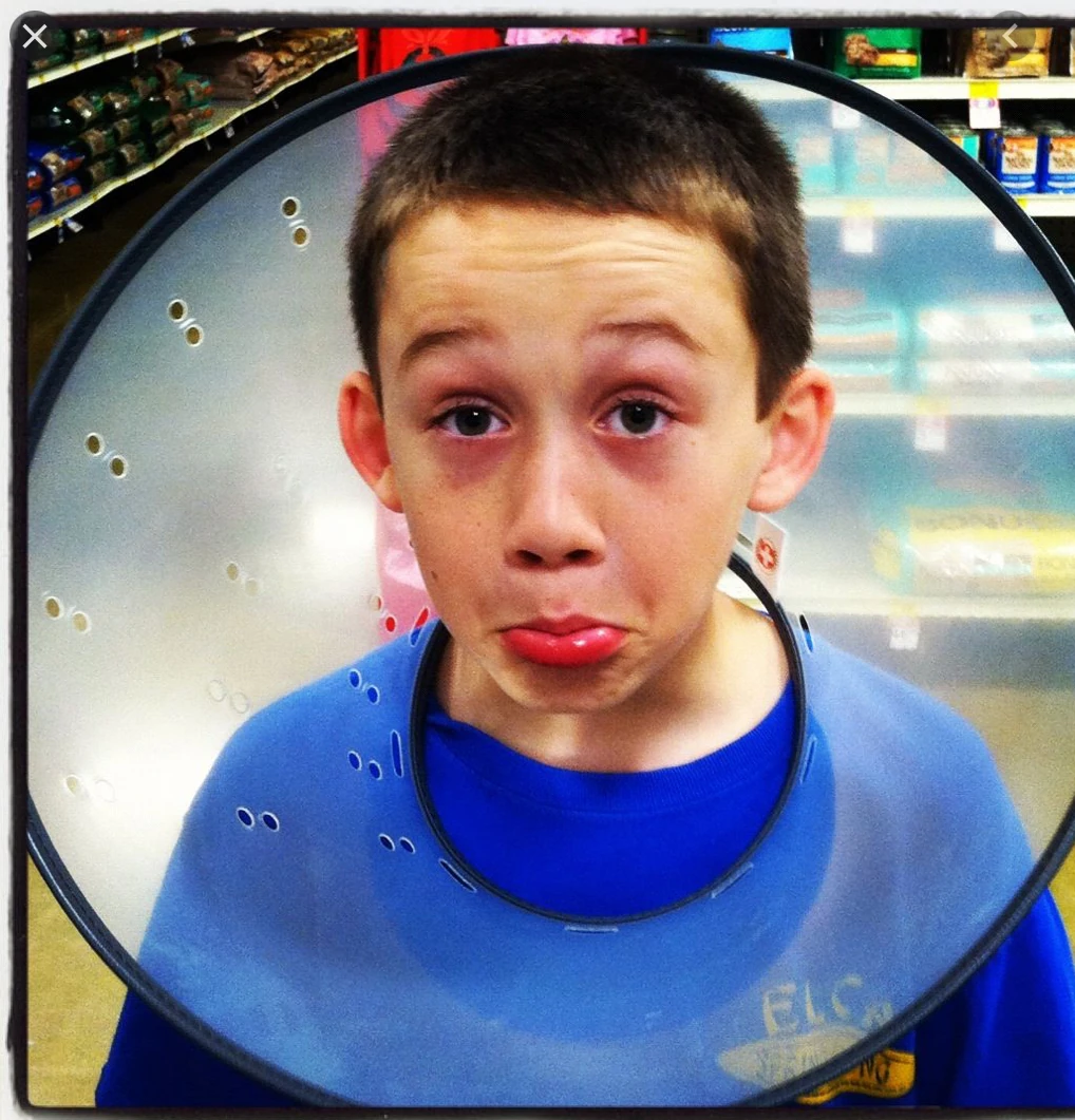 Bad syndrome No pictures! Whoops! Wiki Fandom