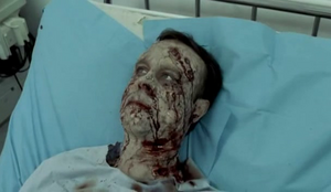 Infected