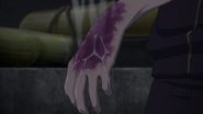 S1E2: Yato's hand is blighted.