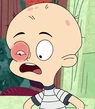 Pinkeye-harvey-street-kids-4.3