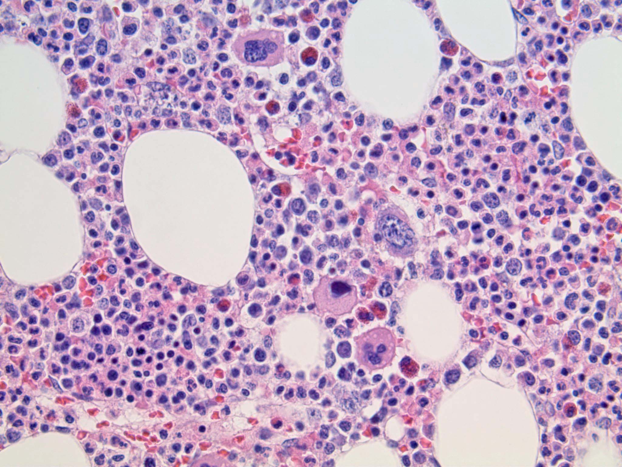 bone marrow cells