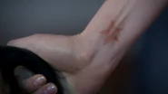 Lily's birthmark, "Lily"