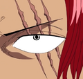 Shanks' Scars.png