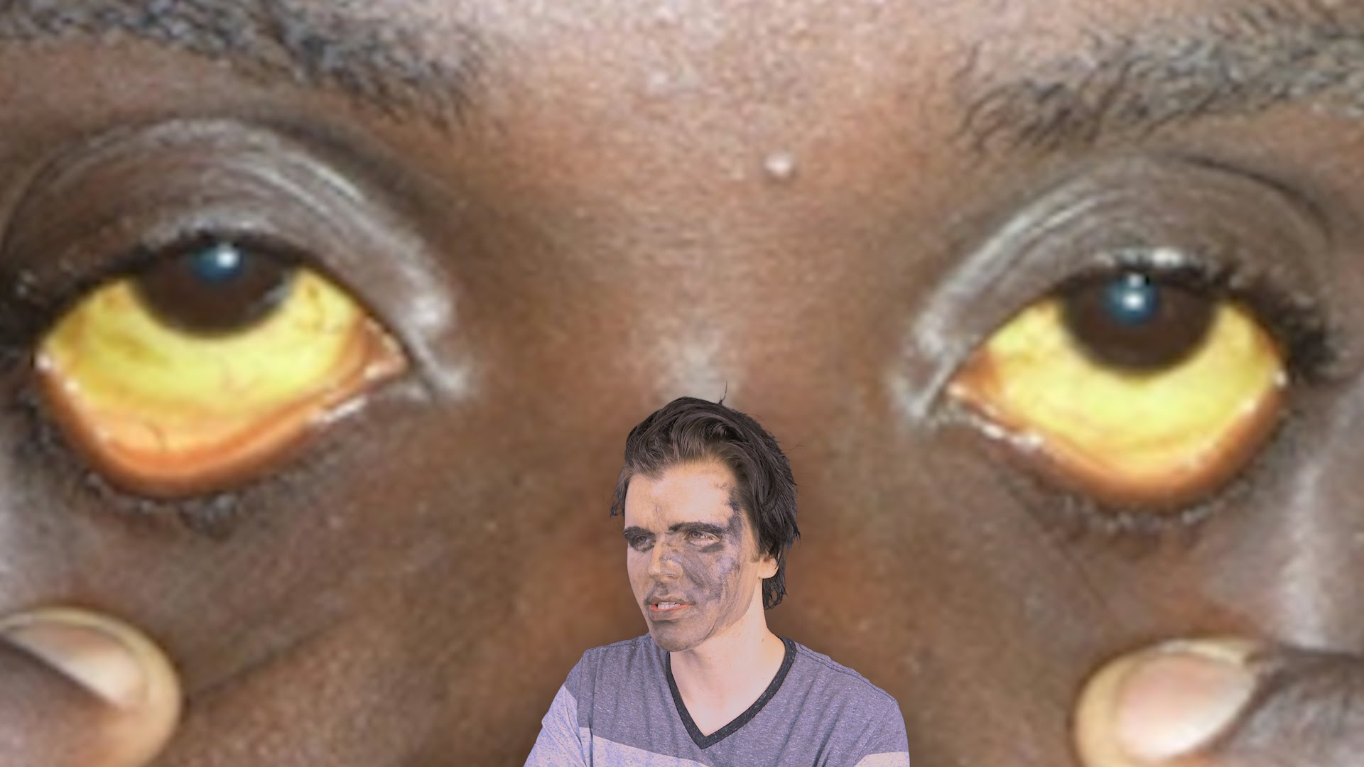 Why Do Black People Have Yellow Eyes Onision Wiki Fandom