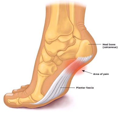 Pronation of the foot - Wikipedia