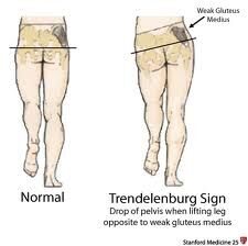 Pronation of the foot - Wikipedia