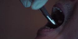Gi-hun replaces his tooth S2 EP2
