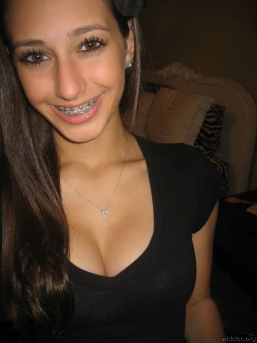 young braces nude 