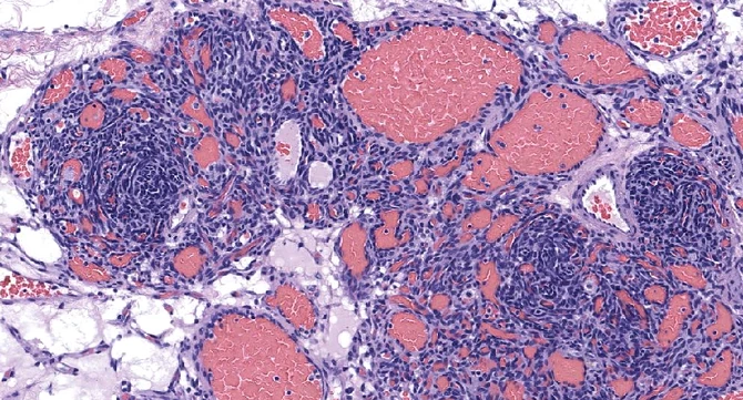 Considering pathology?