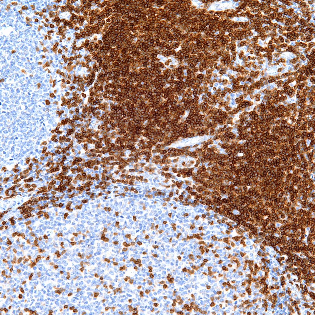 CD3 Pathology Resident Wiki Fandom