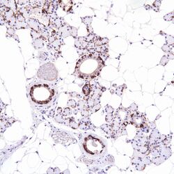 Cytokeratin 5 6 Ck 5 6 Pathology Resident Wiki Fandom