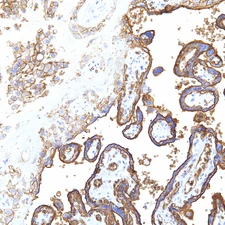 GLUT-1 staining placental trophoblasts.