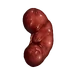 KidneyRight