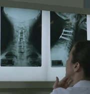Xray.png