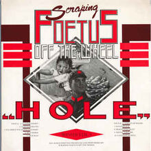 Foetus