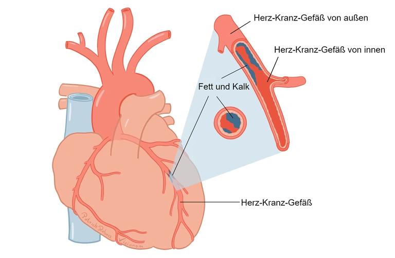 KHK Pflege Wiki Fandom