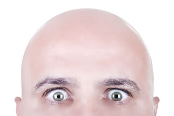 Bald.jpg