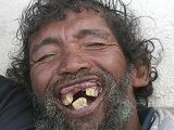 Crackheadphobia