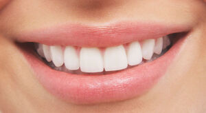 White-Teeth