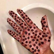 Trypophobia.jpg