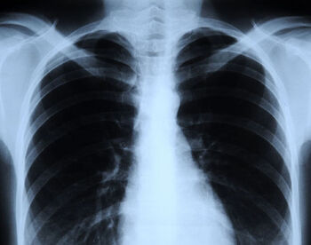 X-ray.jpg