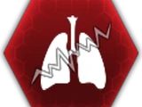 Pulmonary Fibrosis