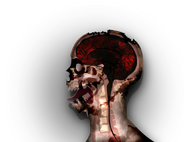 A zombie in the last stage of infection.(Mobile)